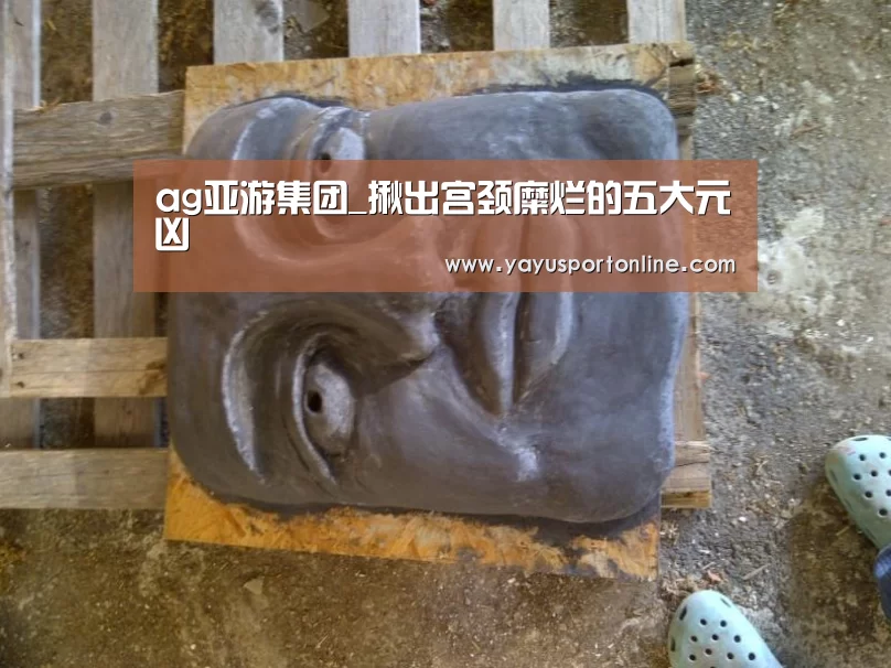 ag亚游集团_揪出宫颈糜烂的五大元凶(图1) AG亚娱