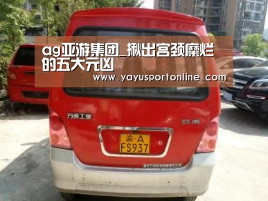 ag亚游集团_揪出宫颈糜烂的五大元凶(图2) ag官网